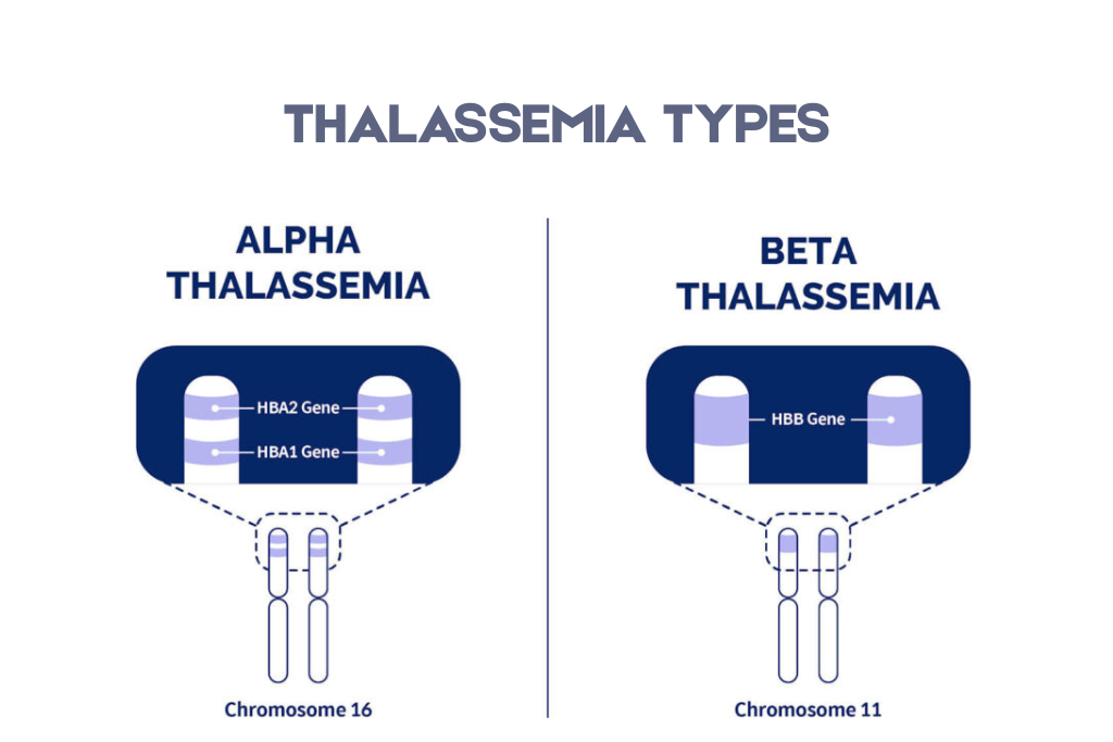 Thalassemia: Causes, Symptoms, Treatment & Top Doctors