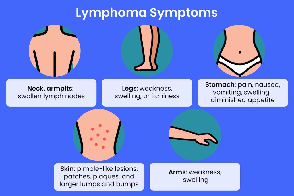 Lymphoma in Children: Symptoms, Causes and Treatment guide