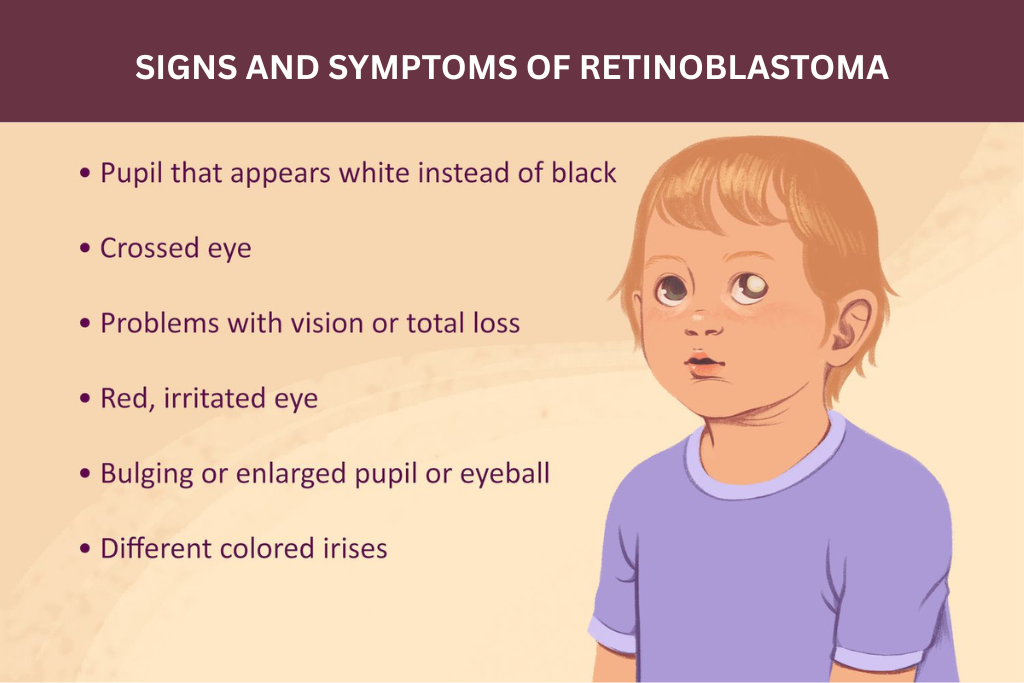 Retinoblastoma in children: Signs, Causes & Treatment Option