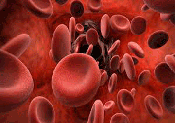 thalassemia